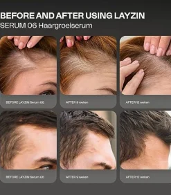 Haargroei Set minder haaruitval en meer haargroei